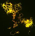 Chording mycobacterium tuberculesis culture