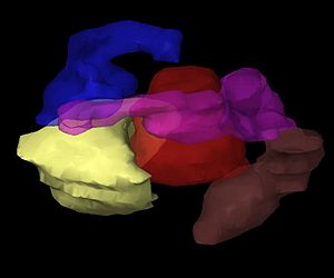 Brachytherapy virtual patient