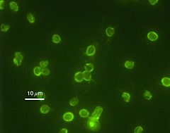 Cryptosporidium parvum 01.jpg