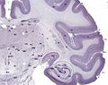 Brainmaps-macaque-hippocampus