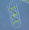 Spirogyra cell