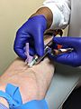 Venipuncture using a BD Vacutainer