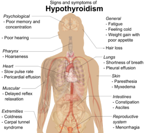 Signs and symptoms of hypothyroidism