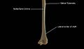 Radial-groove-continuing-as-lateral-border-of-shaft