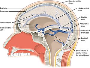 1315 Brain Sinuses