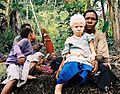 Albinistic girl papua new guinea