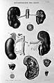 Kidney hypertrophy Wellcome L0005308