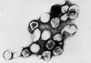 Rubella virus TEM B82-0203 lores