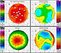 Augenlasern-Voruntersuchung-der-Hornhaut-Topographie-vor-LASIK-OP