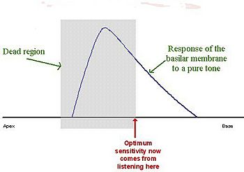 Basilar membrane 2B