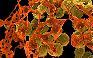 Methicillin-resistant Staphylococcus aureus (MRSA) Bacteria