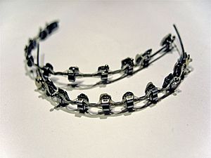 Dental braces