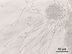 Candida albicans.jpg