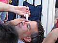 Man taking eyedrops