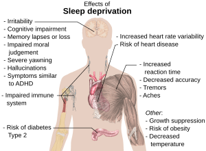 Effects of sleep deprivation