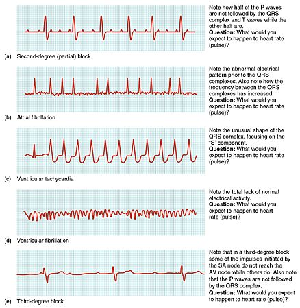 2024 Cardiac Arrhythmias