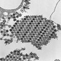 Chikungunya virus particles-PHIL-17369