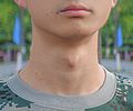 Adam's apple 26