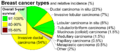 Pie chart of incidence and prognosis of histopathologic breast cancer types