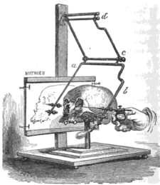 Stereograph Broca