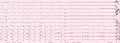 Pacemaker dependent asystole