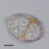 Dinovorax pyriformis PMC5609580 fig1c.png