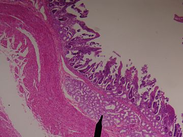 Duodenum-brunner's glands