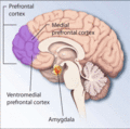 PTSD stress brain