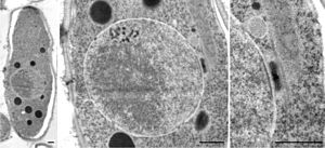 Schizosaccharomyces pombe tsentrosoom