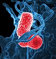 Multidrug-resistant Klebsiella pneumoniaeand neutrophil