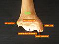 Tibia - inferior epiphysis (anterior view)