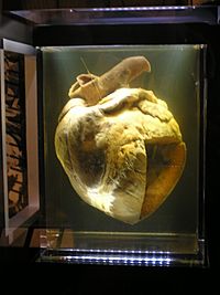 PharLap'sHeart