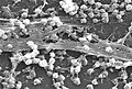 Staphylococcus aureus biofilm 01