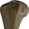 Humerus-Head