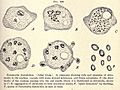 Entamoeba hystolytica