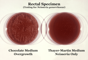 Neisseria gonorrhoeae 01