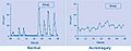 Acromegaly growth hormone levels