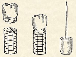 Greenfield implant